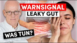 Anzeichen Leaky Gut: Was dahinter steckt und was sie tun können (wichtig!)