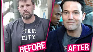 Ben Affleck Before And After Plastic Surgery