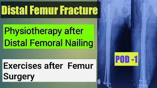 Physiotherapy after Femur surgery.physio after Proximal Femoral Nailing /Distal femoral Nailing.