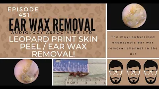 LEOPARD PRINT SKIN PEEL/EAR WAX REMOVAL - EP451