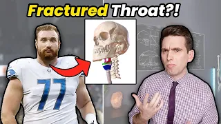 THROAT FRACTURE?? Doctor Explains Strangest NFL Injury Moments Ever!