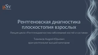 Рентгеновская диагностика плоскостопия взрослых