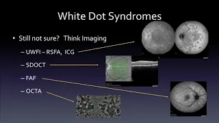 SYM39 12   White Dot Syndromes A Systematic Approach to Diagnosis   Conclusion