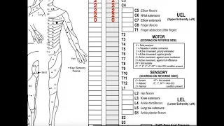 Classifying Spinal Cord Injuries using ASIA Scoring [Explanation + Example 1]