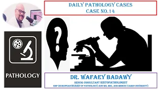 DAILY PATHOLOGY CASES  CASE, NO.  14. BY DR WAFAEY BADAWY