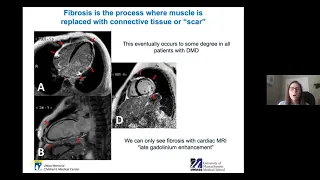 The Cardiologist’s Perspective