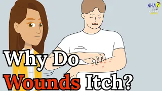 Why Do Wounds Itch?