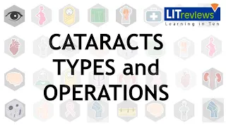 Cataracts  Types and Operations