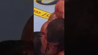 Luke Rockhold Smears His Blood On Paulo Costa Face