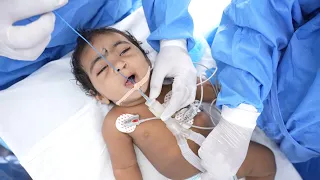 1 Year Old Baby Goes Under Deep Sleep General Anesthesia