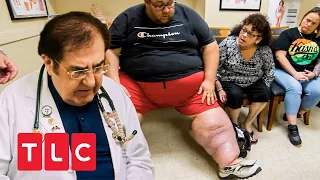 Lymphödeme an den Beinen! | Mein Leben mit 300 kg | TLC Deutschland