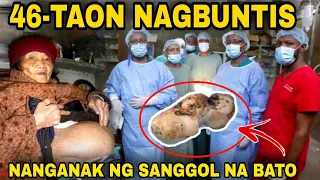 NAGULAT ANG MGA DOCTOR, Babaeng 46 TAONG BUNTIS, nanganak ng isang bato na sanggol? | TRUE STORY
