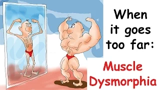 Muscle Dysmorphia: When it goes too far. (Bigorexia)