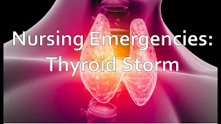 Thyroid Storm