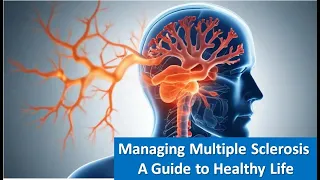 Managing Multiple Sclerosis A Guide to Healthy Life
