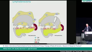 William Allum, UK: Quality assurance in upper GI cancer