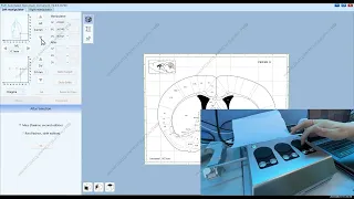 Automated stereotaxic instrument operation video