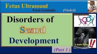 Fetus Ultrasound, Disorders of Sexual Development -Part1