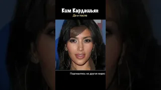 Ким Кардашьян до и после