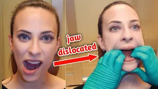 شاهد كيف يتم اصلاح الفك المخلوع_dislocated jaw repair