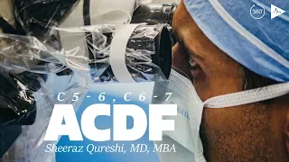 C5-6, C6-7 Anterior Cervical Discectomy and Fusion | Case Trailer
