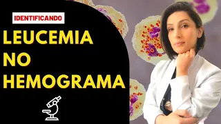 Como identificar Leucemia no hemograma - Biomedicina #biomedicina #hematologia