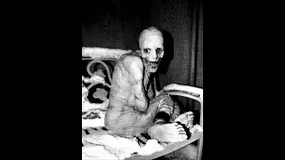 The Russian Sleep Experiment