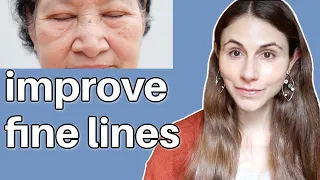 How to IMPROVE FINE LINES on the EYELIDS | Dr Dray