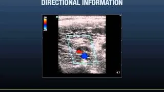 Ultrasound Podcast - Doppler Ultrasound