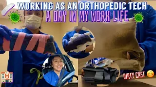 MY DAY WORKING AS AN ORTHOPEDIC TECH/ TRAUMA SEASON/ STINKY CASTS