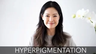 Treating Hyperpigmentation | How to Fade Dark Spots