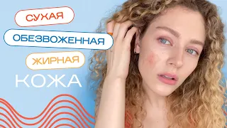 Сухая, жирная, обезвоженная КОЖА - что делать?