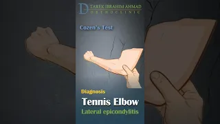 cozen's test for tennis elbow - lateral epicondylitis