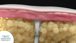 QWO Mechanism of Action