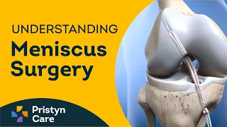 What is Meniscus Surgery | Understanding Meniscus Surgery