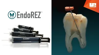 EndoRez™ root canal sealer