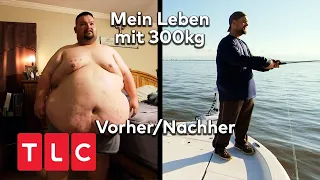 Vorher/Nacher: Die größten Erfolge | Mein Leben mit 300 kg | TLC Deutschland