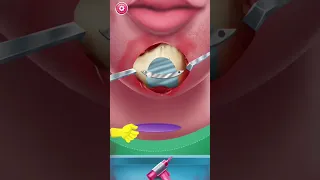 Open mouth surgery 🫀 Doctor Games #Shorts#androidgames#iosgaming#gaming