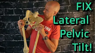 Lateral Pelvic Tilt Correction Exercises - Why It Happens and What YOU Can Do