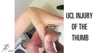 UCL injury of the thumb: Mechanism of injury and treatment options