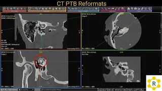 How to reformat CT PTBs