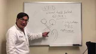 Visual field defects without MRI / structural correlate