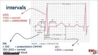 EKG interpretation