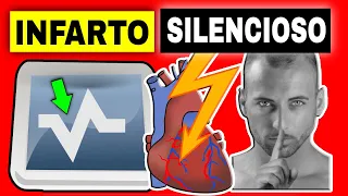 7 SIGNS of SILENT MIOCARDIAL INFARCTION (HEART ATTACK WITHOUT SYMPTOMS)