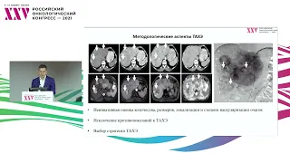 Рентгеноэндоваскулярные методы при метастазах нейроэндокринных опухолей в печени