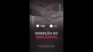 Como é feita a Inserção do #IMPLANON | Dra. Fernanda Taumaturgo