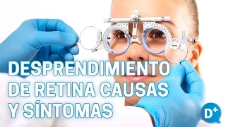 Causas y síntomas del desprendimiento de retina