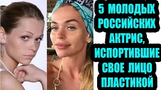 5 молодых российских актрис, которые испортили свое лицо пластикой