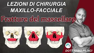 Lezioni di Chirurgia Maxillo Facciale: Le fratture del mascellare superiore di Le Fort