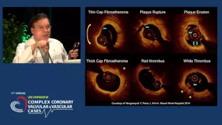 Role of Invasive Imaging During PCI